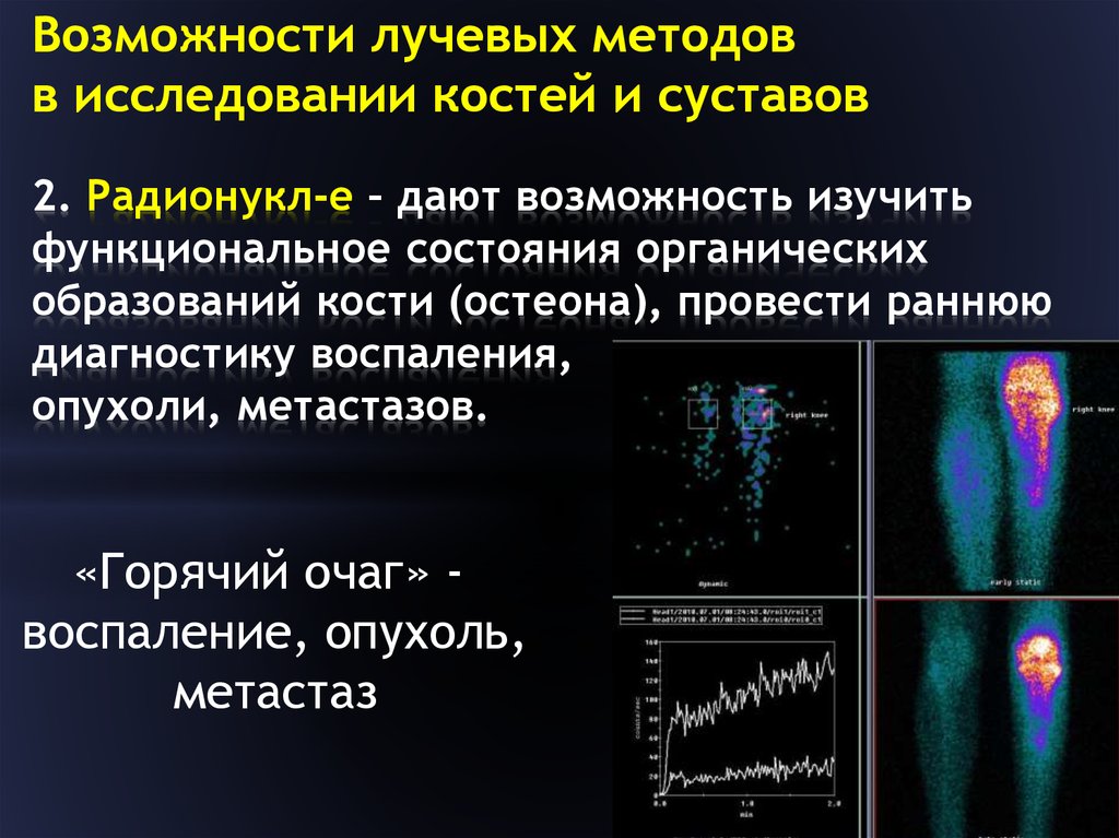 Диагностика заболеваний суставов презентация