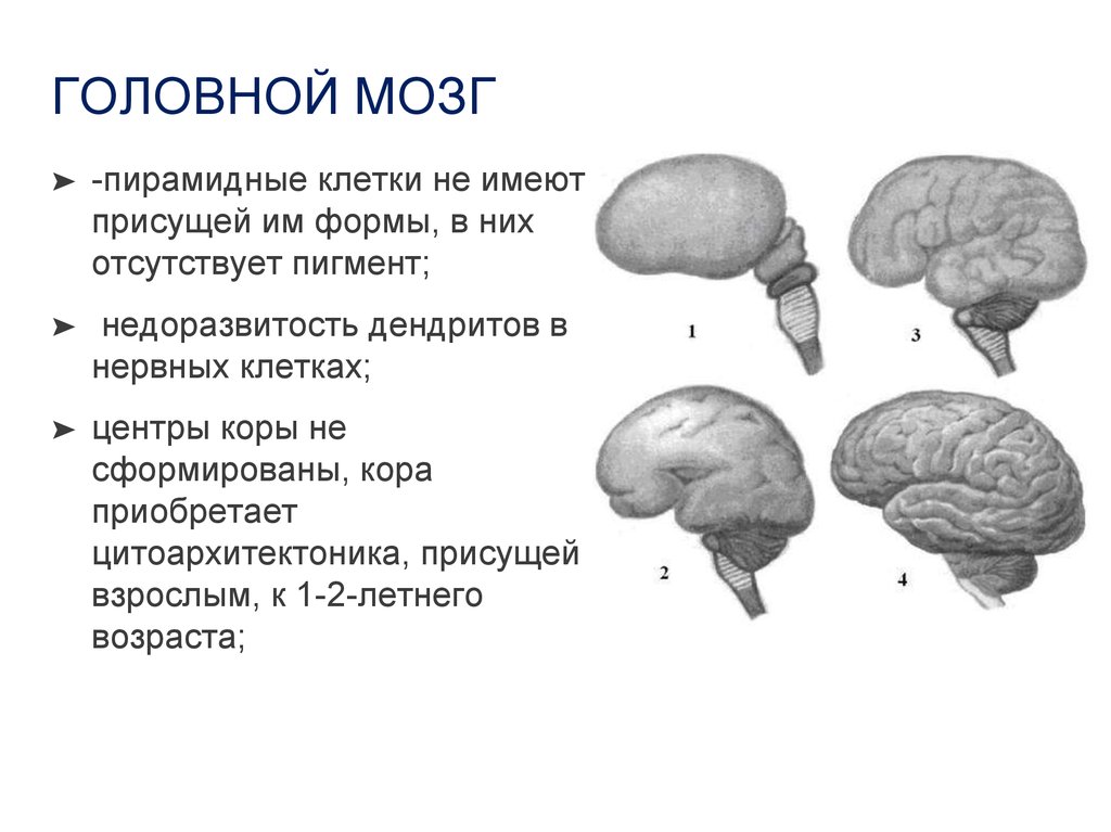 Мозг новорожденного масса. Строение головного мозга для детей. Недоразвитие коры головного мозга. Особенности головного мозга у детей.