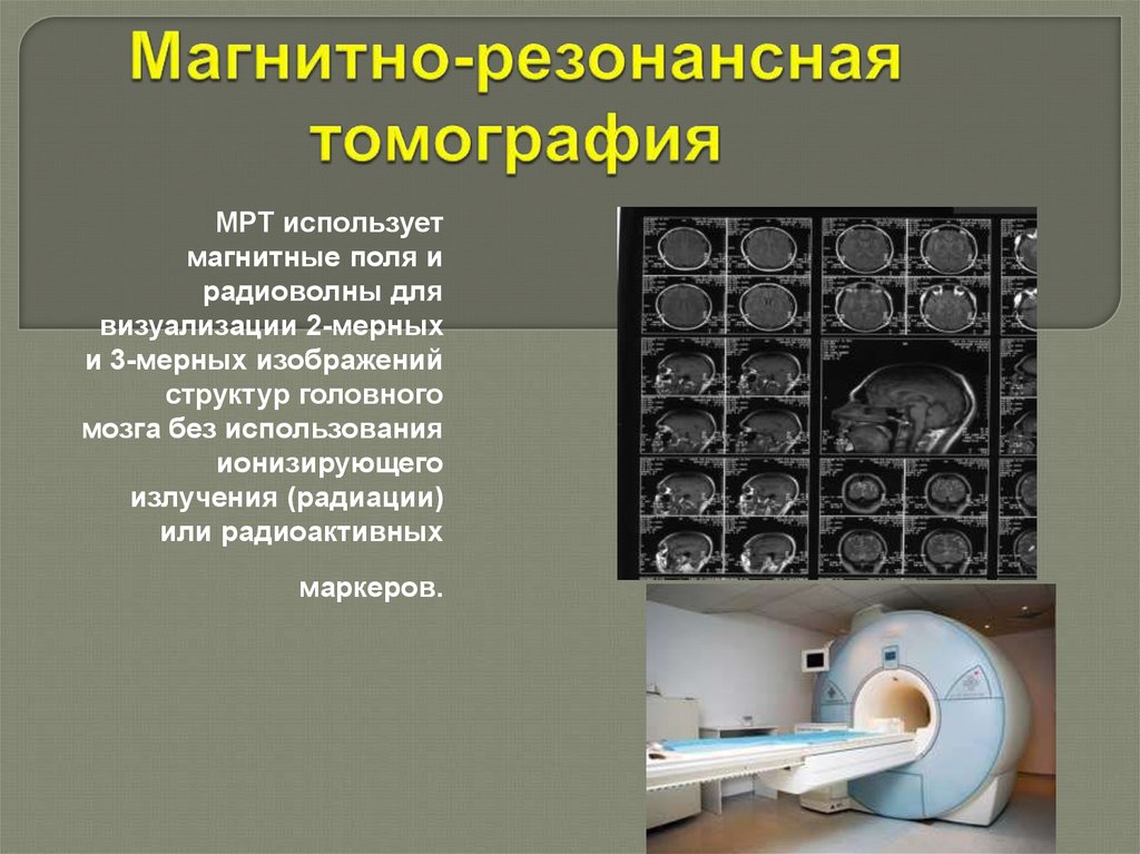 Функциональная мрт презентация