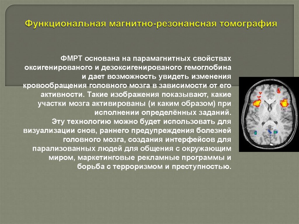 Функциональная магнитно-резонансная томография