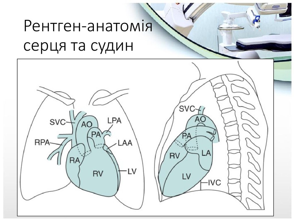 Рентген-анатомія серця та судин