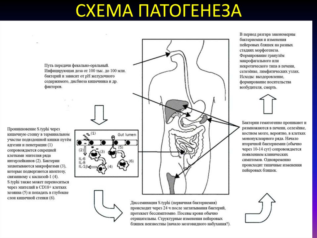 Патогенез дизентерии схема