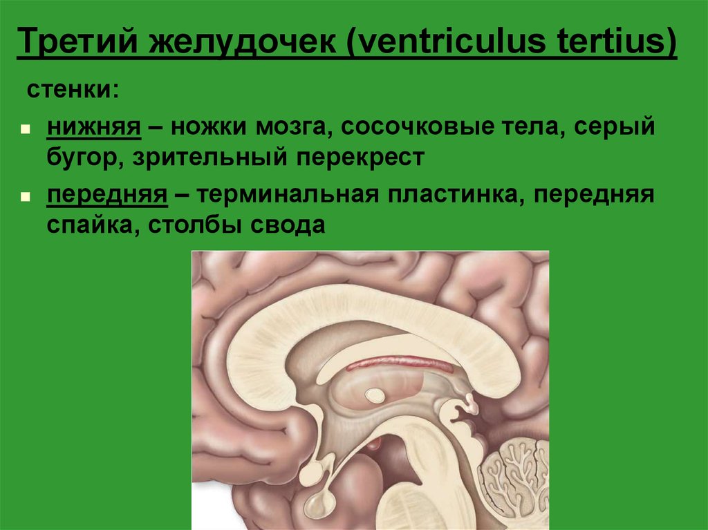 Треть третьего. 3 Желудочек головного мозга стенки. Стенки третьего желудочка. 3 Желудочек анатомия. 3 Желудочек промежуточного мозга.