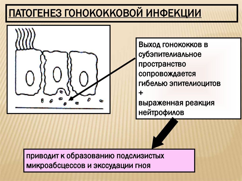 Презентация на тему гонорея