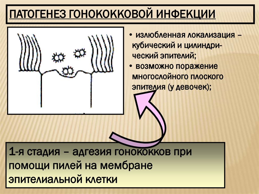 Презентация на тему гонорея 8 класс