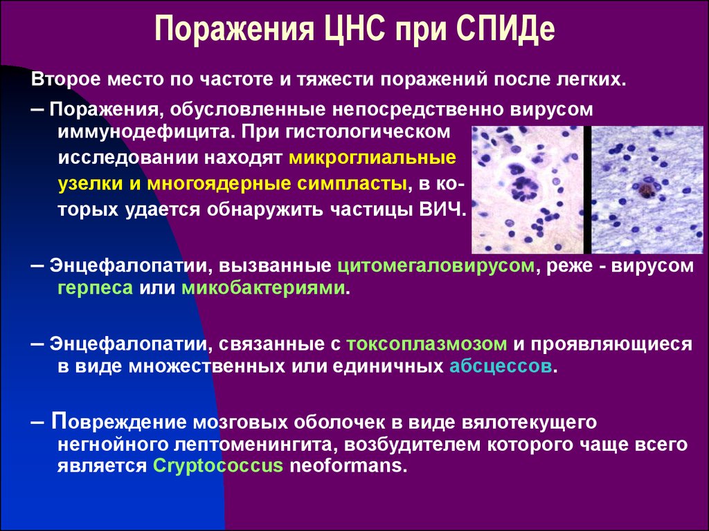 Заболевание центральной системы. Поражение ЦНС при ВИЧ-инфекции. Поражение ЦНС при ВИЧ. Поражение нервной системы при СПИДЕ. Поражение нервной системы при ВИЧ.