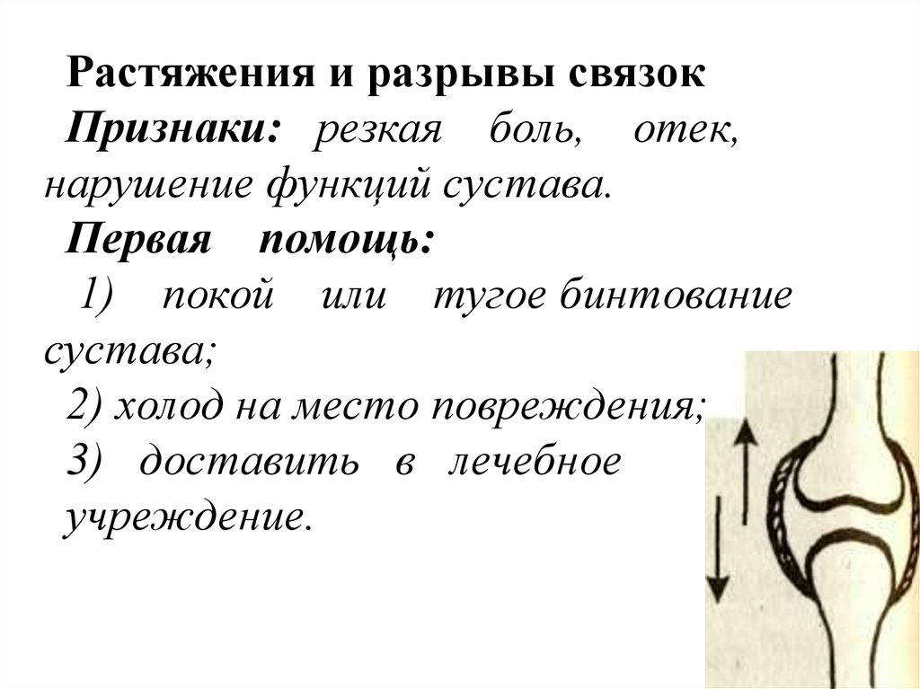 Первый сустав. Функции суставов. Нарушение функции сустава. Растяжение связок признаки и первая помощь. Разрыв связок признаки и первая помощь.