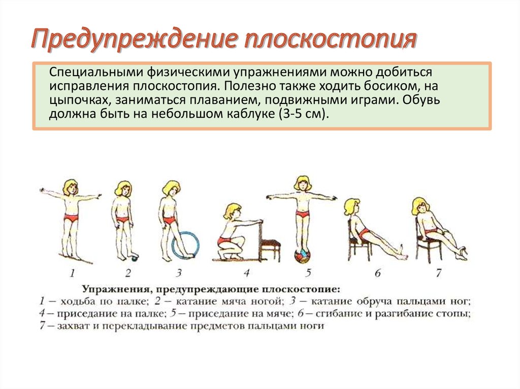 Утренняя гимнастика как предупредить плоскостопие проект