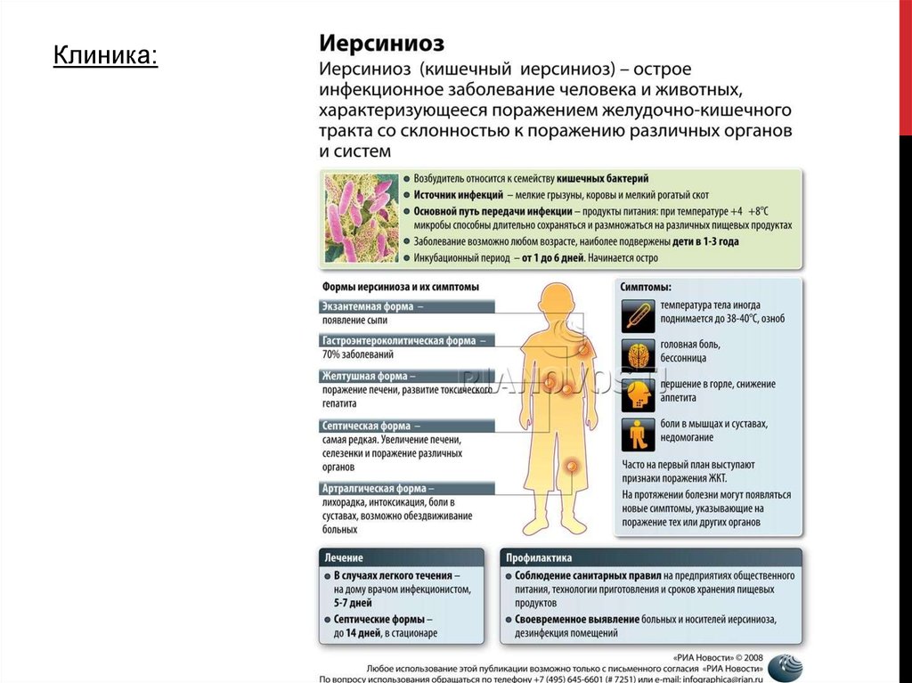 Иерсиниоз что это. Кишечный иерсиниоз синдромы. Симптомы кишечного иерсиниоза. Кишечный иерсиниоз профилактика.