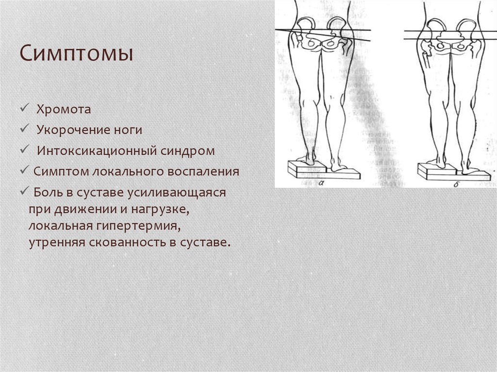 Коксартроз презентация травматология