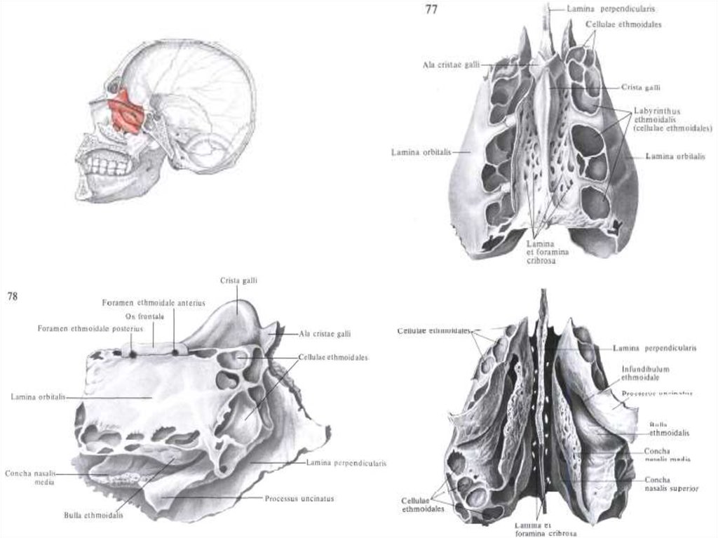 Продырявленная пластинка решетчатой кости. Решетчатая кость анатомия человека атлас. Lamina cribrosa решетчатой кости. Решетчатая кость Сапин. Решетчатая кость КРС сбоку.