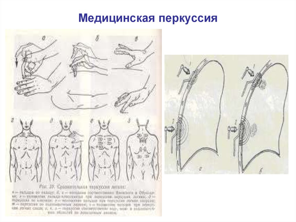 Формы грудной клетки