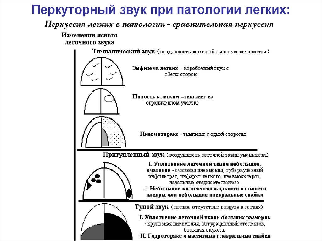 Характер перкуторного звука