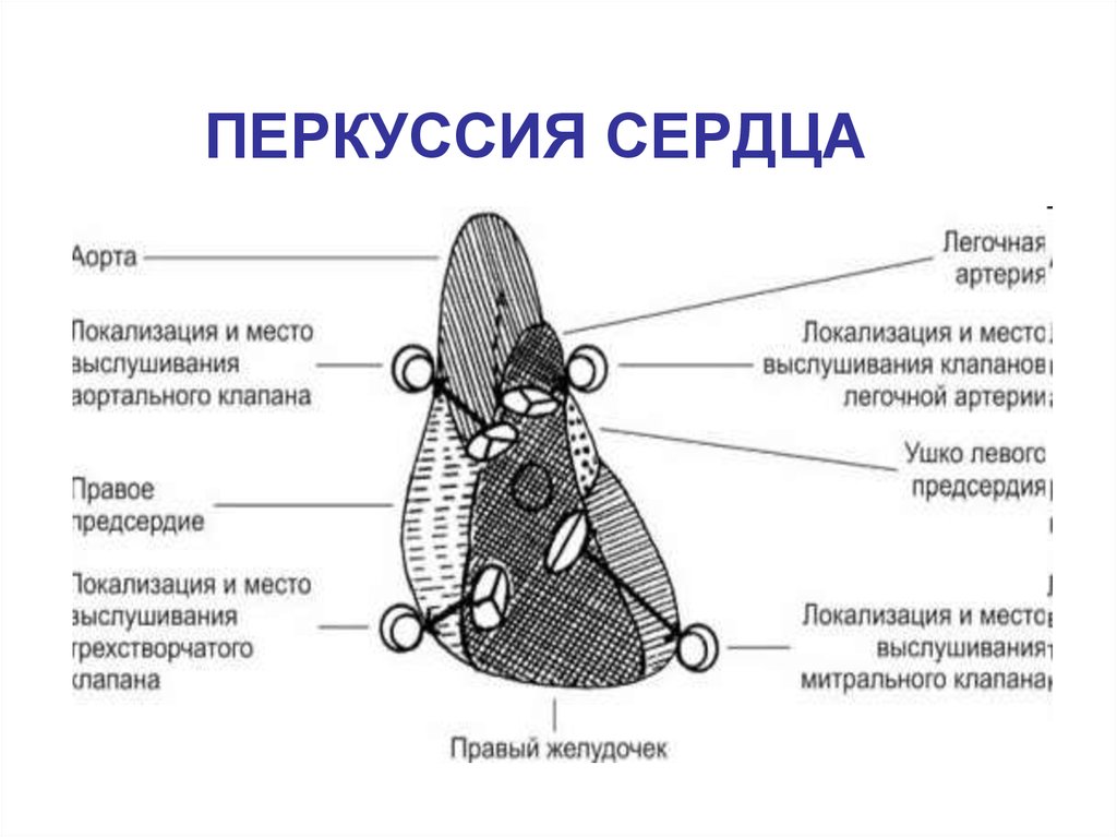 Клапан легочной артерии. Перкуссия сердца пропедевтика внутренних болезней. Перкуссия сердца пропедевтика алгоритм. Перкуссия сердца локализация. Место выслушивания легочной артерии.