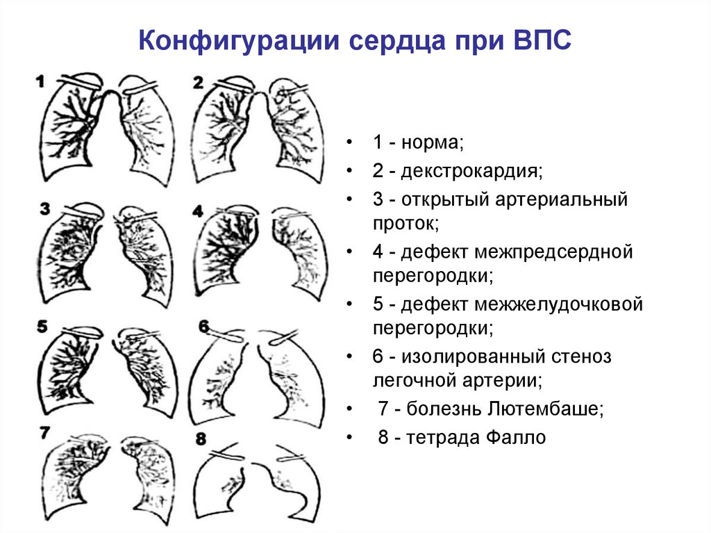 Нормальная конфигурация сердца рисунок