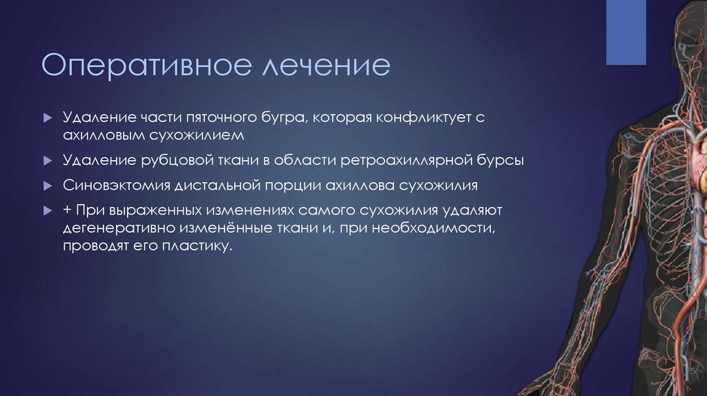 Оперативное лечение