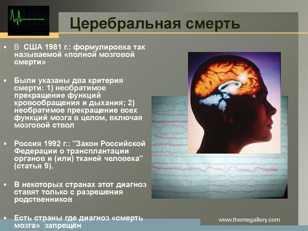 Необратимые нарушения головного мозга. Клиническая смерть мозга. Смерть мозга последствия.