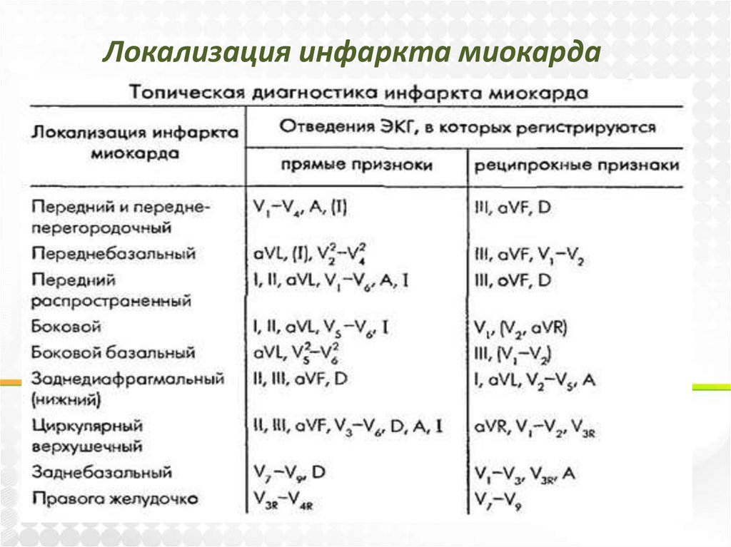 Диагностика инфаркта. Инфаркт миокарда ЭКГ реципрокные изменения. ЭКГ диагностика инфаркта миокарда по локализации. Топика инфаркта миокарда на ЭКГ. Топическая диагностика инфаркта миокарда таблица.