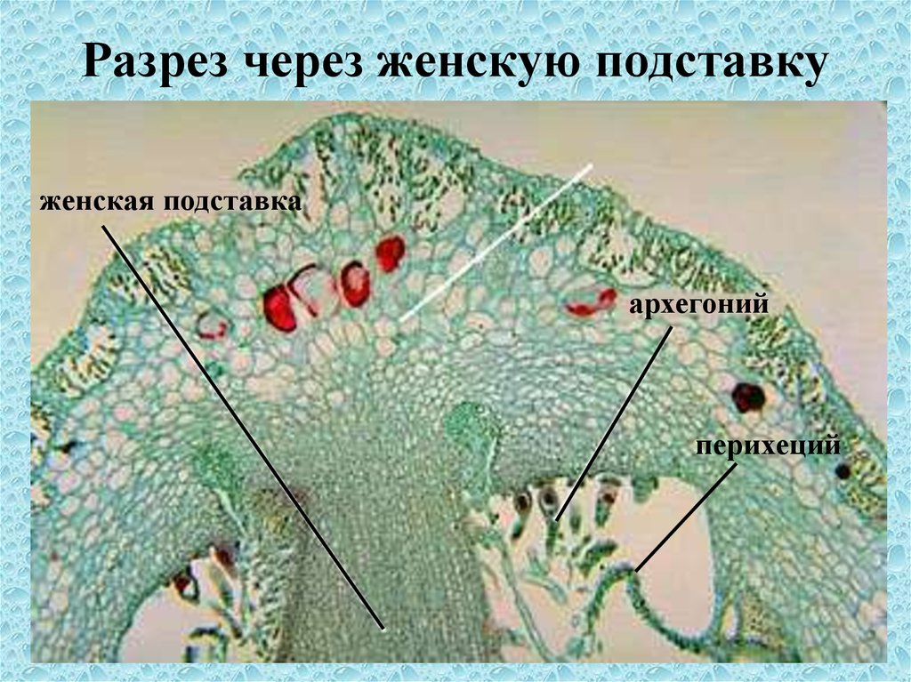 Разрез через. Продольный срез архегониев маршанции. Антеридии маршанции под микроскопом. Строение архегония маршанции. Продольный срез архегониальной подставки маршанции.