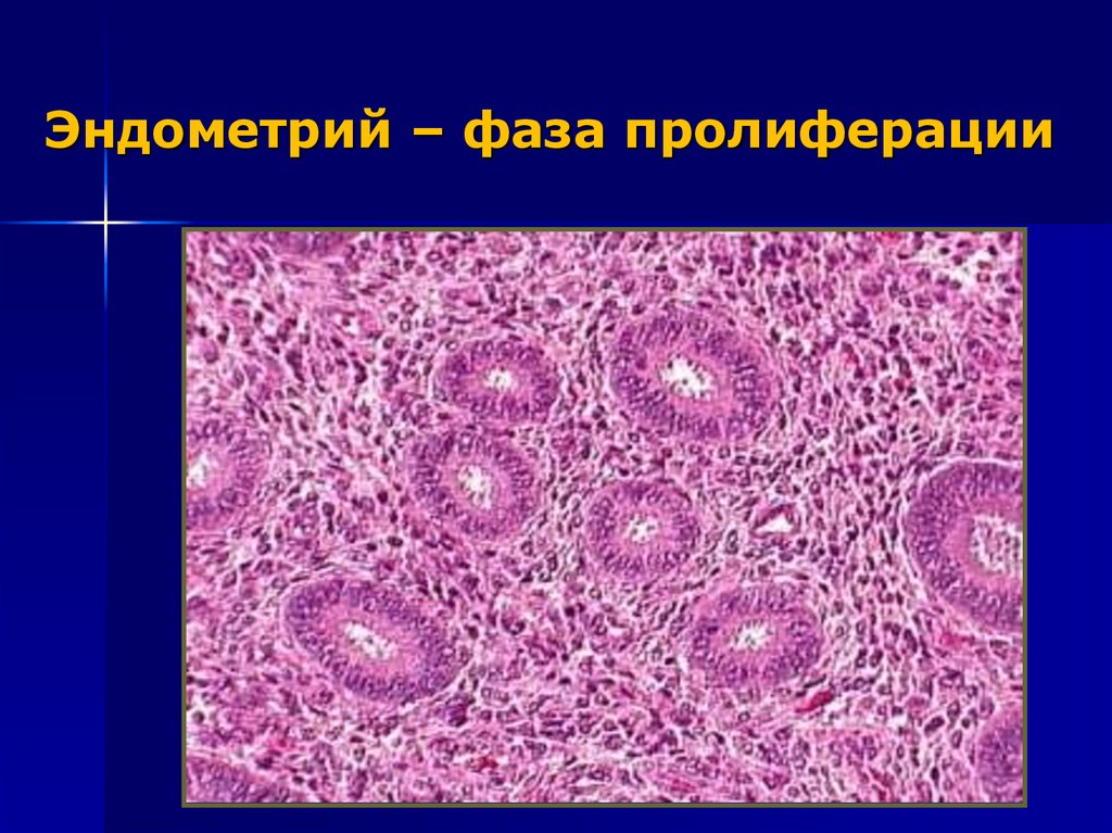 Эндометрий средней пролиферации