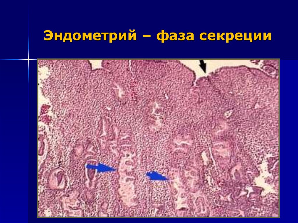 Эндометрия ранней стадии секреции. Пролиферация эндометрия гистология. Ранняя фаза секреции эндометрия гистология. Пролиферативная фаза эндометрия. Эндометрий матки гистология пролиферативная фаза.