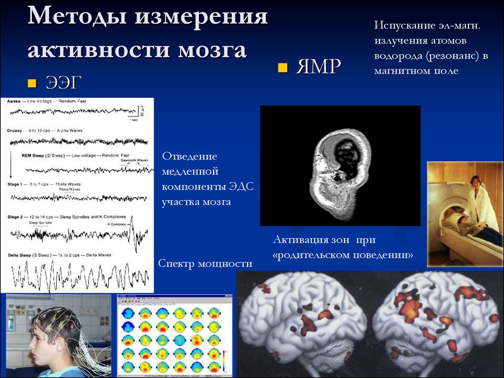 Методы измерения активности мозга