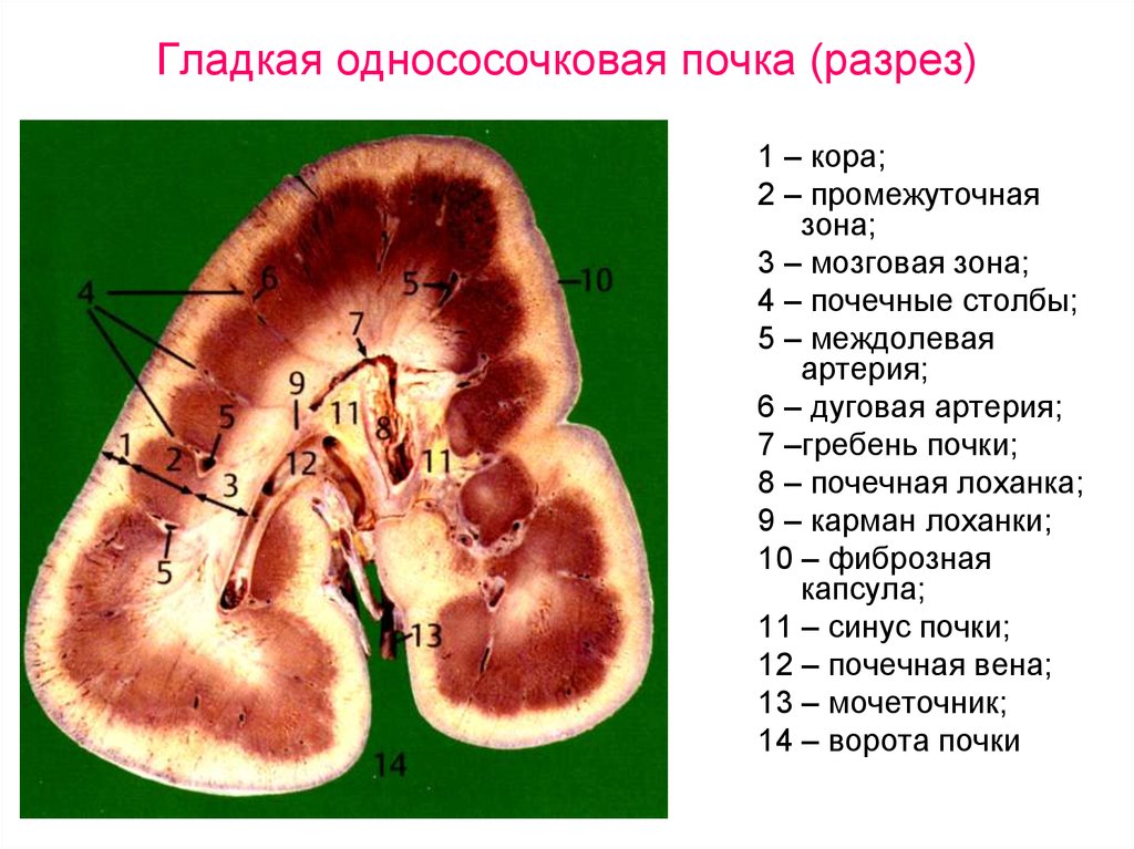 Почка в разрезе анатомия фото