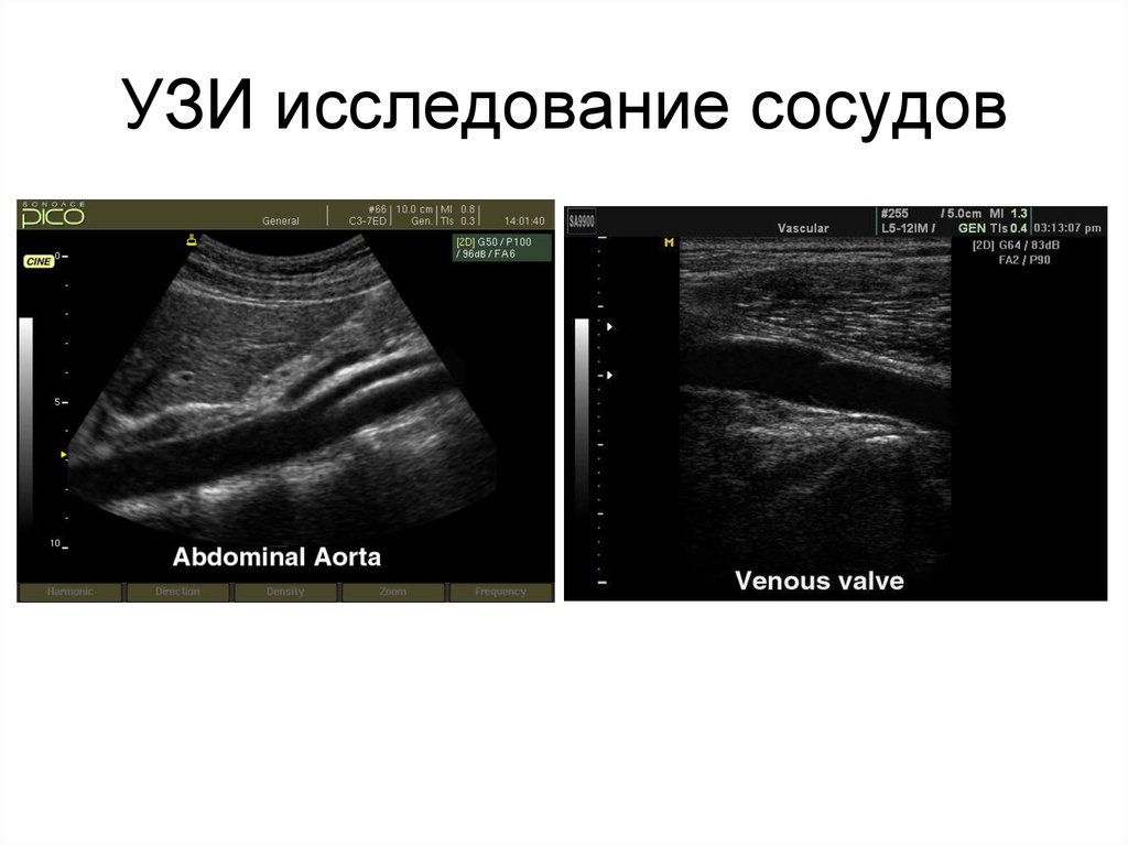 УЗИ исследование. Ультразвуковые исследования сердечно-сосудистой системы. УЗИ сосудов книги. Книги по УЗИ сосудов.