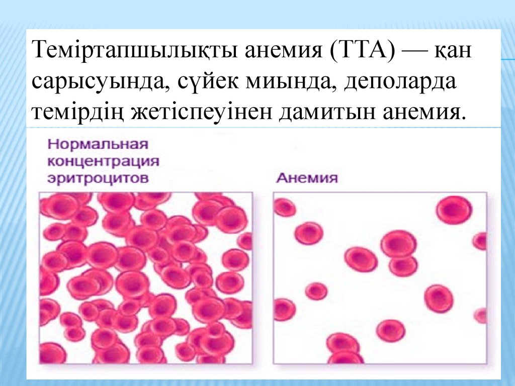Анемия и вес. Презентация на тему анемия. Анемия эритроциты. Презентация по анемии.