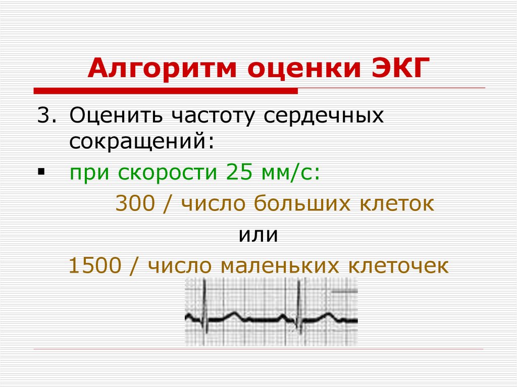 Экг презентация қазақша