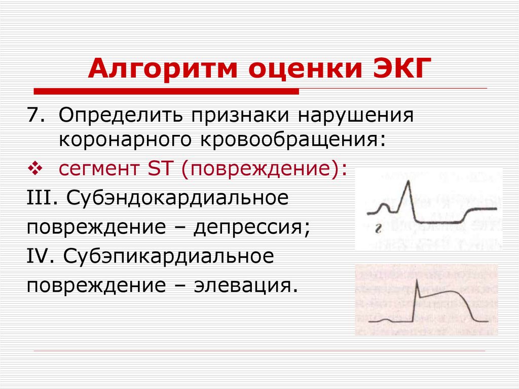 Алгоритм экг. Субэпикардиальное повреждение на ЭКГ. Субэндокардиальное повреждение на ЭКГ. Элевация ст на ЭКГ. Алгоритм оценки ЭКГ.