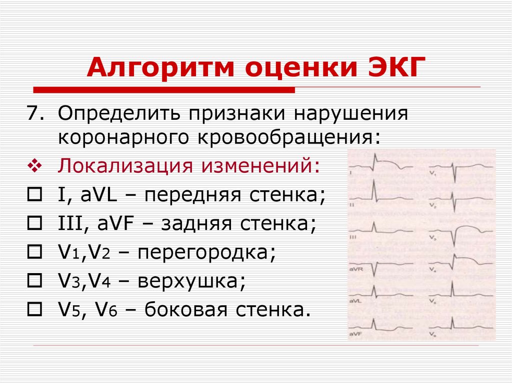 Презентация экг для студентов