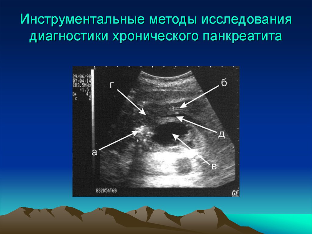 Хронические исследования. Инструментальные исследования хронического панкреатита. Хронический панкреатит диагностика. Методы исследования хронического панкреатита. Инструментальные методы диагностики хронического панкреатита.