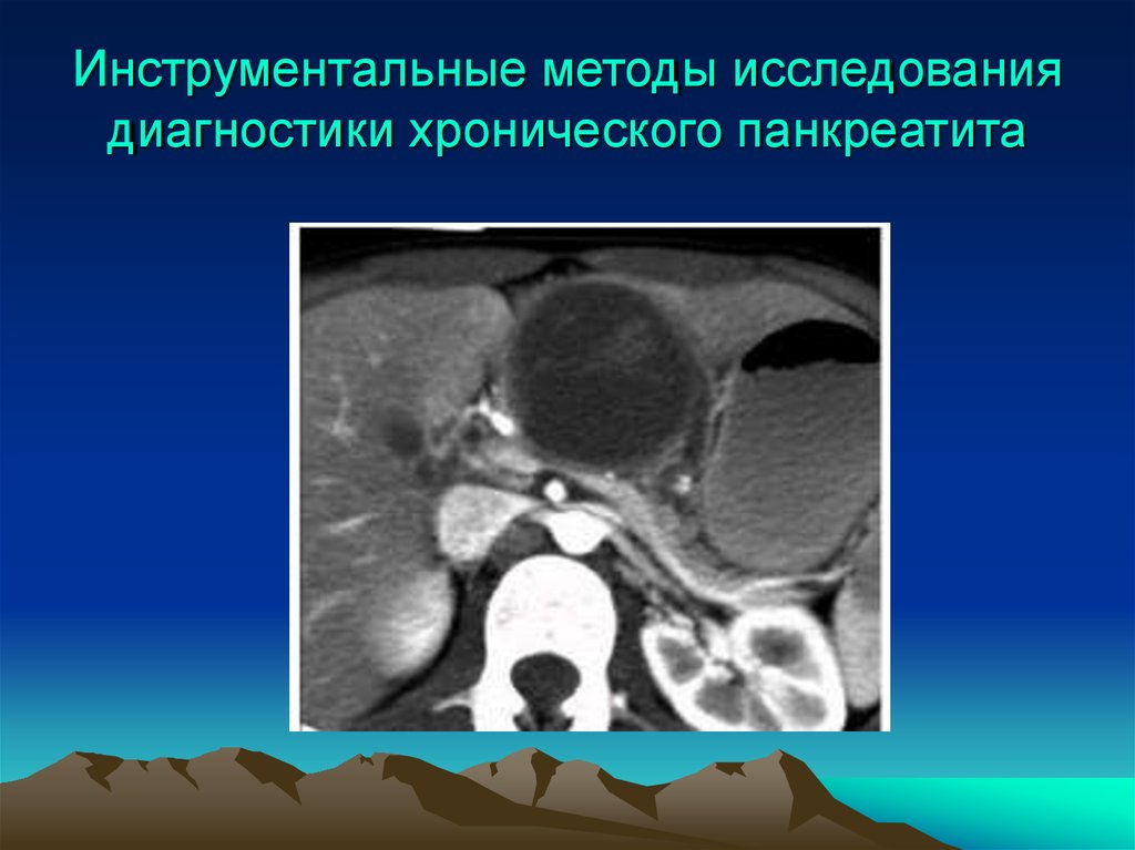 Исследования острого панкреатита. Инструментальные исследования острого панкреатита. Хронический панкреатит инструментальные исследования. Инструментальные методы исследования панкреатита. Методы исследования хронического панкреатита.