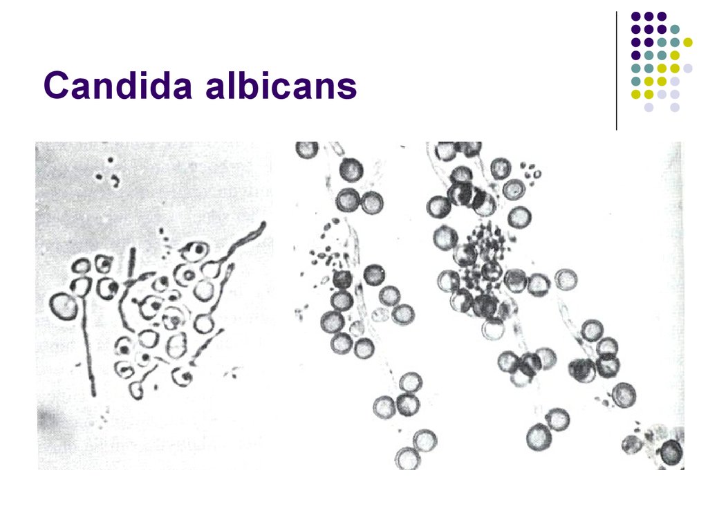 Candida albicans лечение. Candida альбиканс. Типы клеток Candida albicans. Кандида аблиганс рисунок.