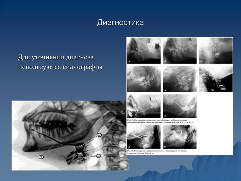 Диагностика