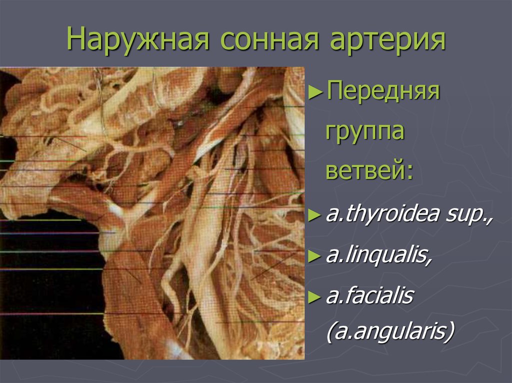 Наружная сонная. Передняя группа наружной сонной артерии. Ветви передней группы наружной сонной артерии.