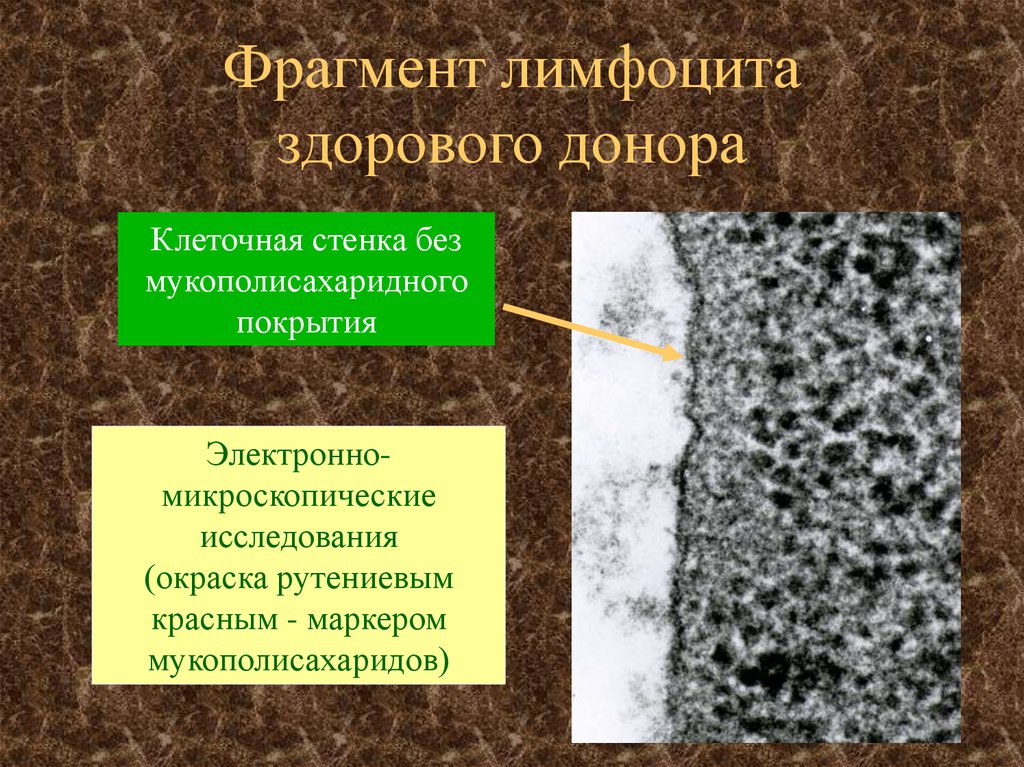 Фрагмент лимфоцита здорового донора