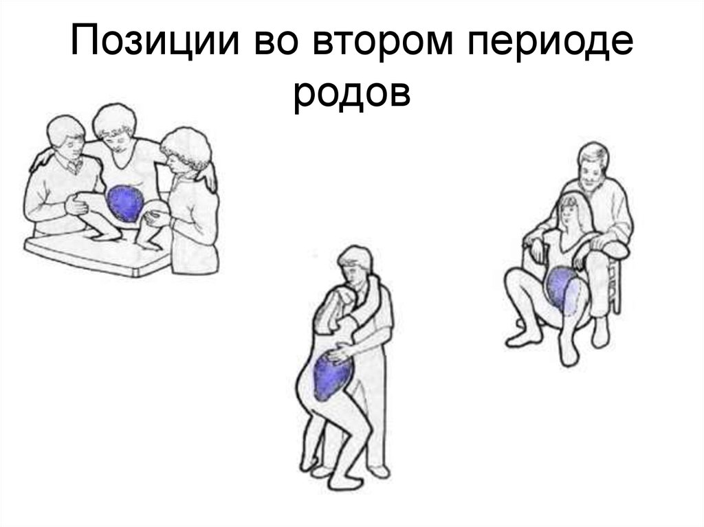 Правила родов. Позиции во втором периоде родов. Позы во втором периоде родов. Позы для партнерских родов.