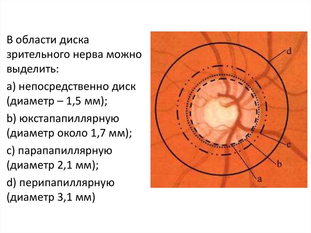 Схема глазного дна