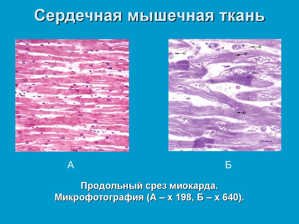 Поперечно полосатая сердечная мышечная ткань гистология рисунок