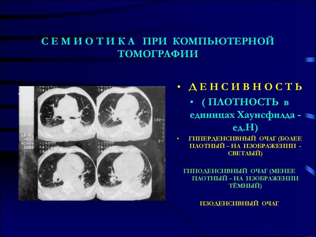 Использование двухэнергетического сканирования при выполнении компьютерной томографии позволяет