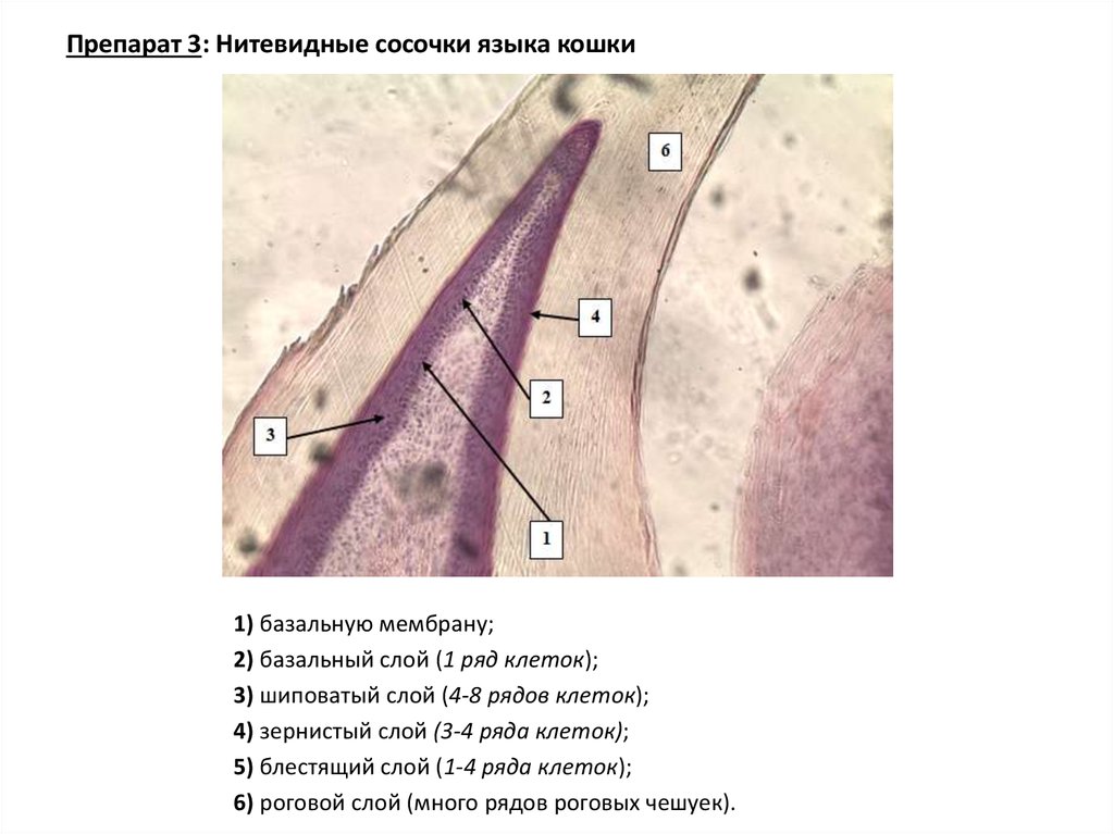 Ряд слой. Нитевидные сосочки препарат. Нитевидные сосочки языка кошки. Базальная мембрана шиповатый слой. Описание препарата нитевидные сосочки.