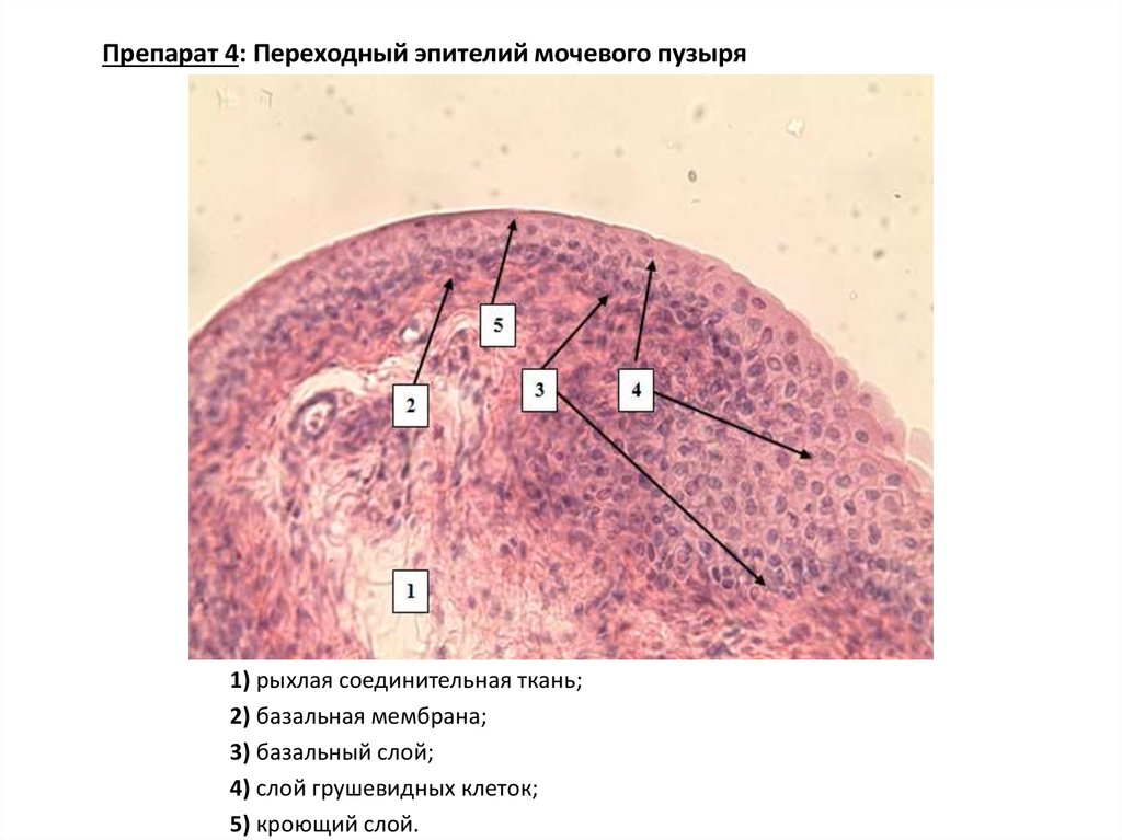 Обнаружены клетки эпителия базально парабазального слоев. Переходный эпителий мочевого пузыря препарат. Рыхлая соединительная ткань эпителий. Эпителий мочевого пузыря гистология. Переходный эпителий мочевого пузыря гистология.