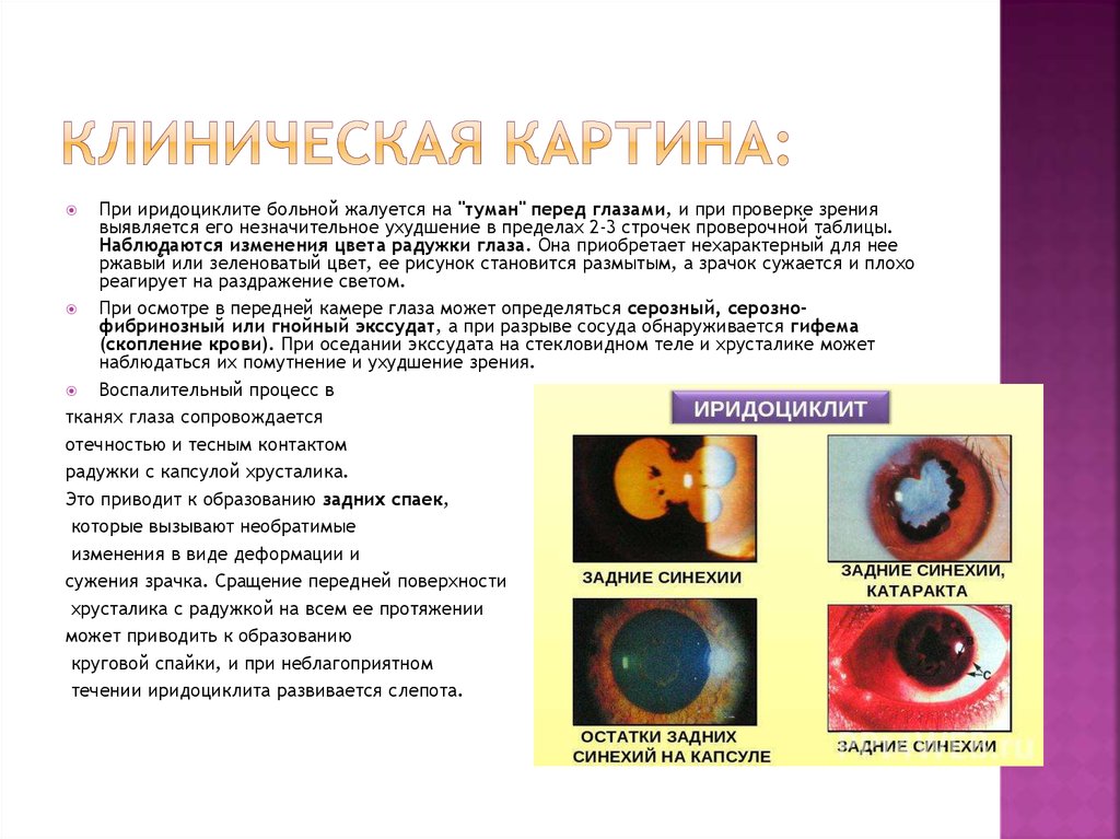 Клинические рекомендации офтальмология