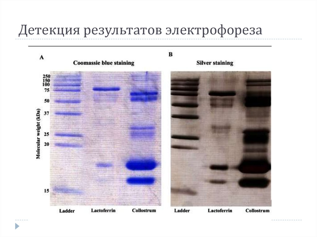 Детекция. Детекция продукта ПЦР электрофорезом. Электрофореграмма результатов ПЦР. Интерпретация результатов ПЦР электрофорез. Детекция результатов это.