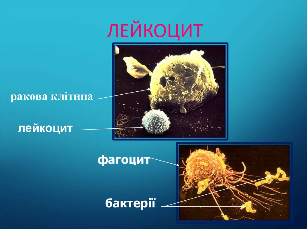 Фагоциты и лимфоциты. Лейкоциты и фагоциты. Лейкоциты фагоциты и лимфоциты. Макрофаги, фагоциты, лимфоциты. Фагоциты и лимфоциты разница.