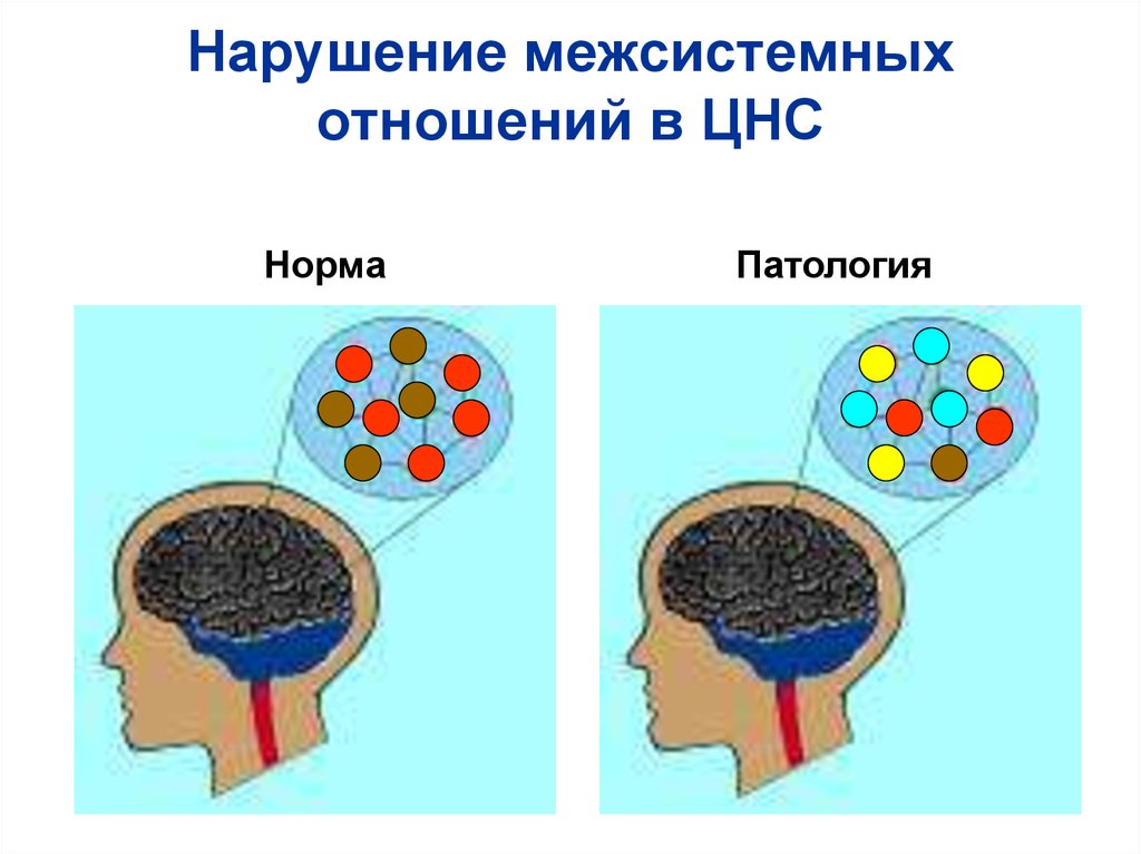 Норма и патология. Нарушения межсистемных отношений в нервной системе. Эндогенные причины нарушений деятельности нервной системы. Нарушение межсистемных взаимодействий в нервной системе. Нарушения системных отношений в ЦНС.