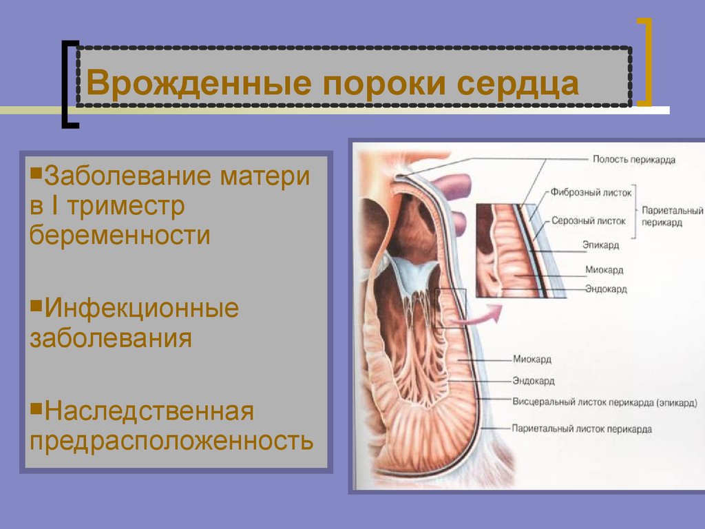 Врожденное расстройство