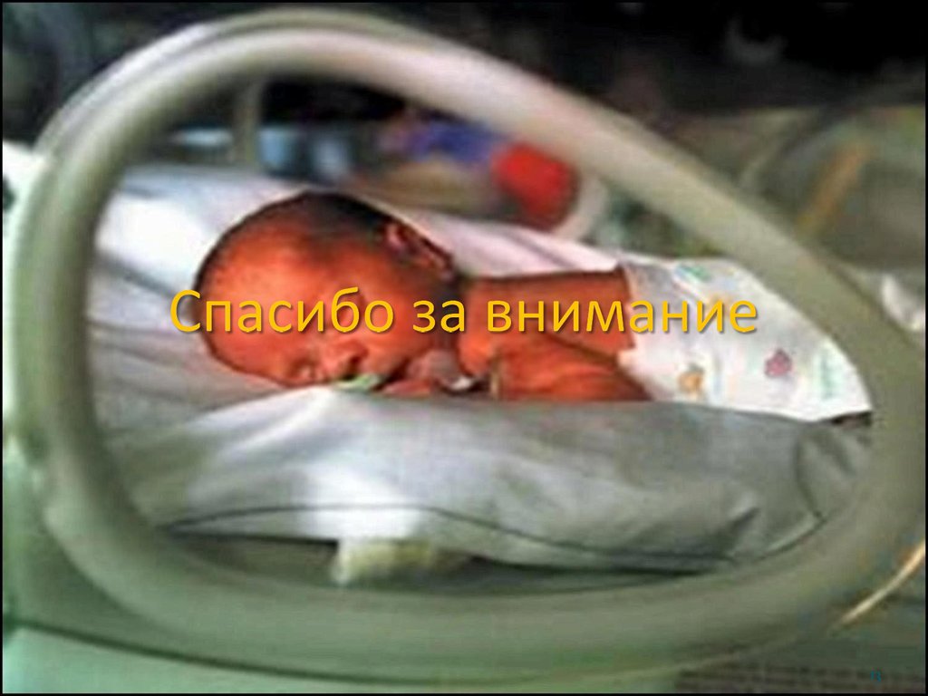 Недоношенный кровоизлияние. Выхаживание недоношенных. Недоношенный новорожденный. Дети с экстремально низкой массой тела.